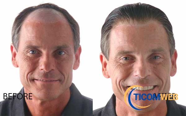 BISOÑE   PARA   HOMBRES   LIMA   PERU   CFL   :   999023200