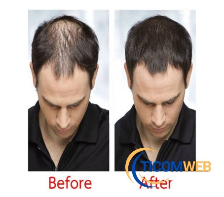 PELUCAS   PARA  HOMBRES    LIMA  PERU